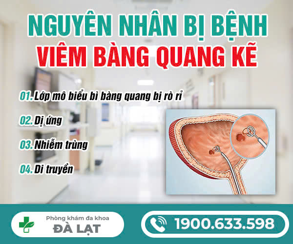 Hình ảnh minh họa